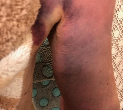 Loveland police face federal civil rights lawsuit over arrest of 73-year-old woman – The Denver Post